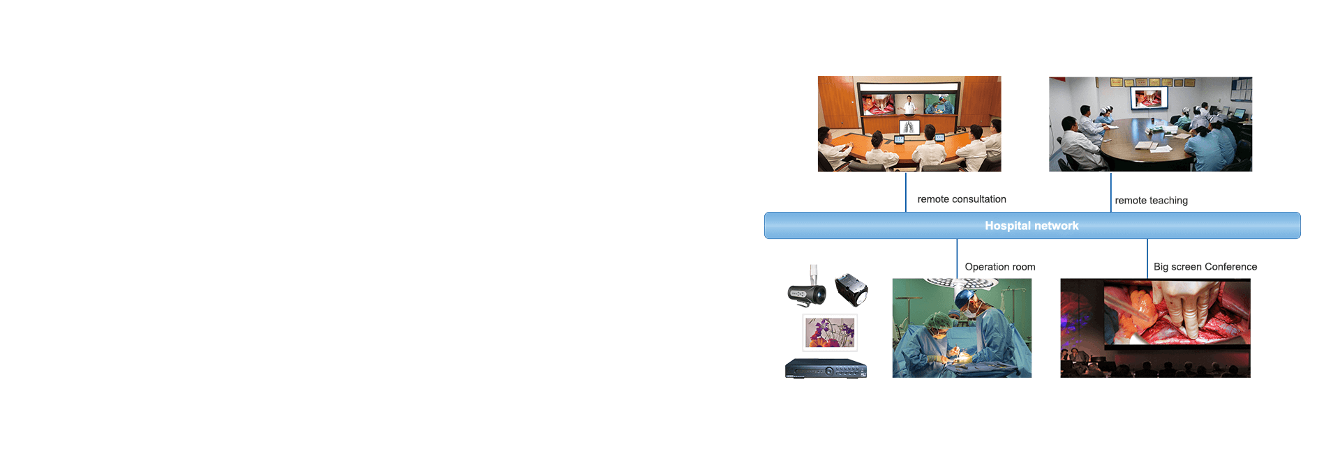 Optional HD Camera System